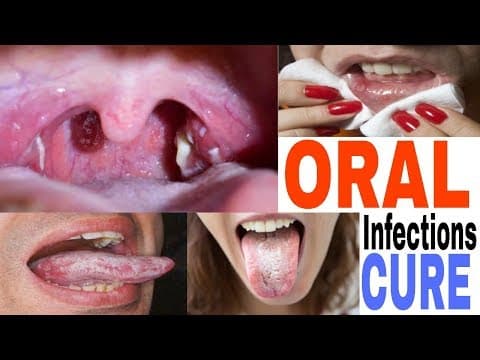 Recent post by Dr. Shubham Srivastava