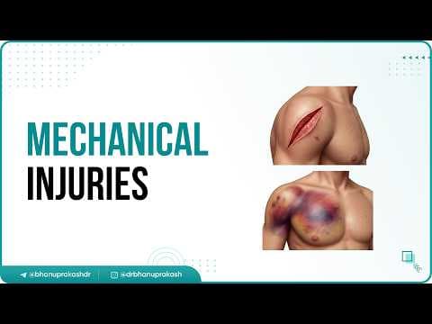 Recent post by Dr.G Bhanu Prakash Animated Medical Videos