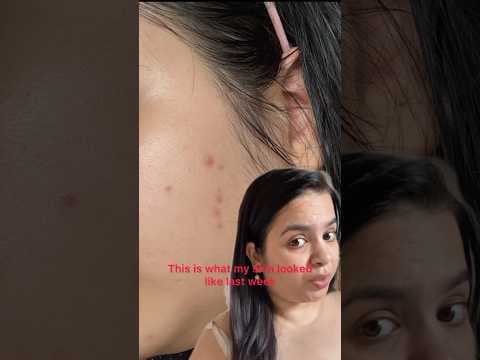 Recent post by Priyanka Sharma